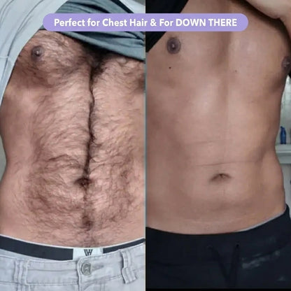 Nurelia® Hair Removal Moisse