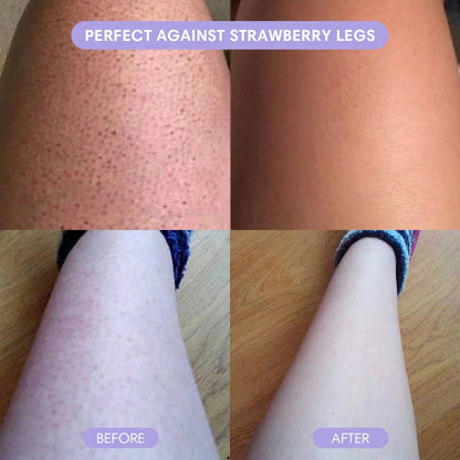 Nurelia® Hair Removal Moisse